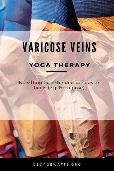 Varicose Veins Yoga Therapy Precautions